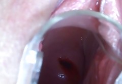 Weird blondie gets her pussy lips stretched with vaginal speculum